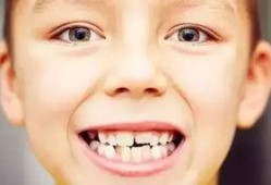 吃瓜掉牙齿视频大全下载,视频大全下载精选集