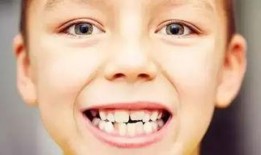 吃瓜掉牙齿视频大全下载,视频大全下载精选集